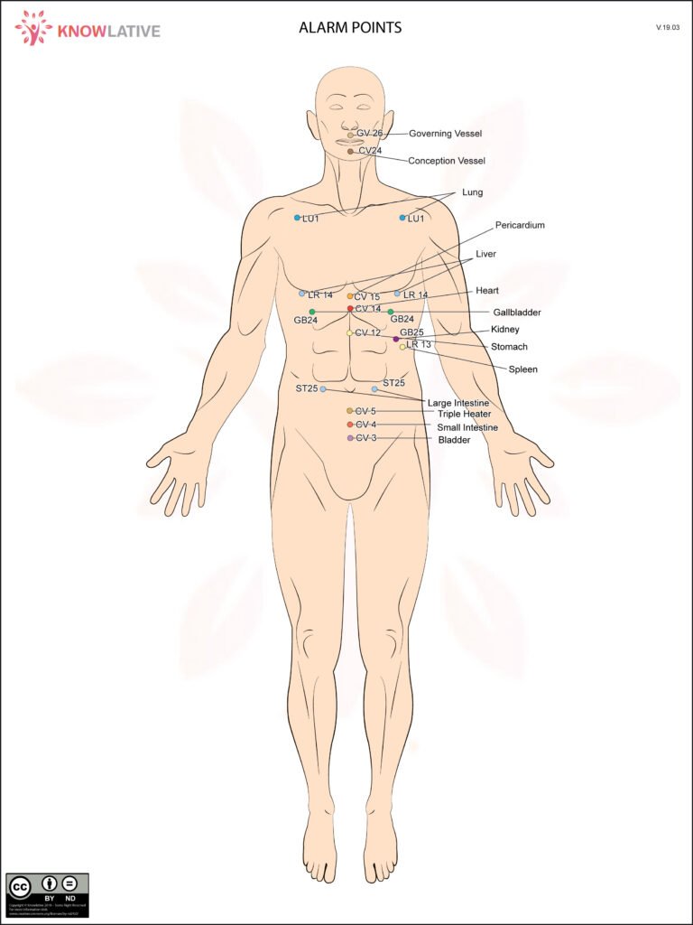 Alarm Point – Picture 2