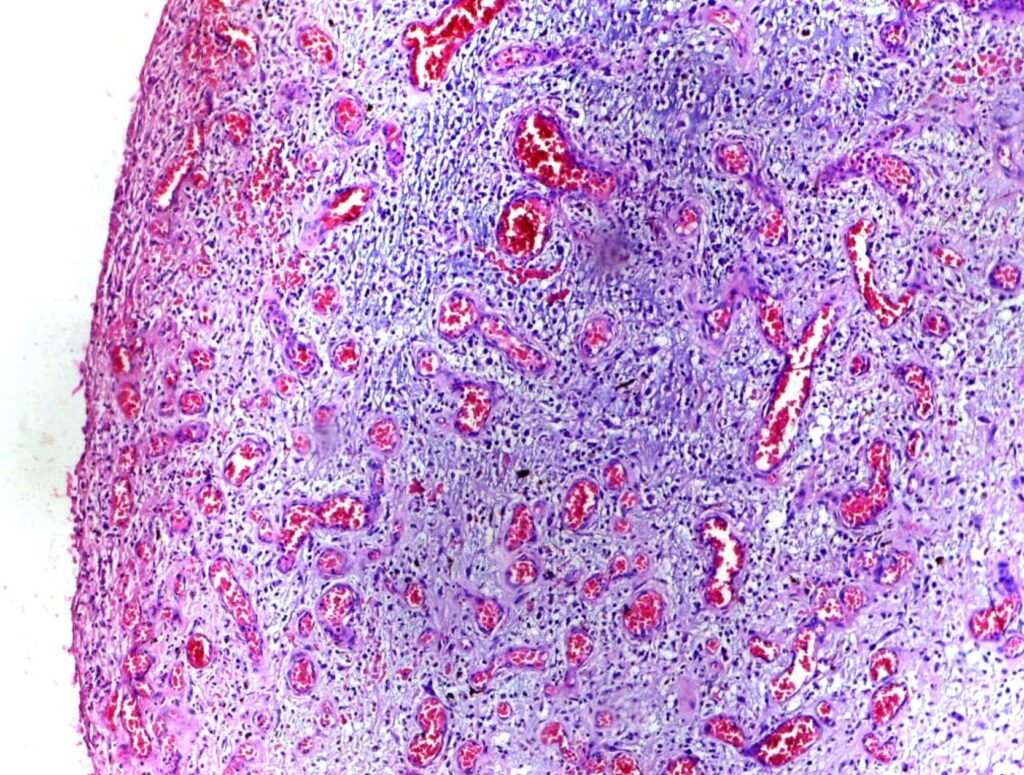 Inflamación – Imagen 1